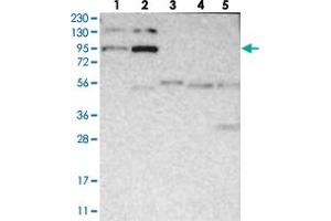 Western blot analysis of Lane 1: RT-4, Lane 2: U-251 MG, Lane 3: Human Plasma, Lane 4: Liver, Lane 5: Tonsil with FER polyclonal antibody  at 1:250-1:500 dilution. (FER 抗体)