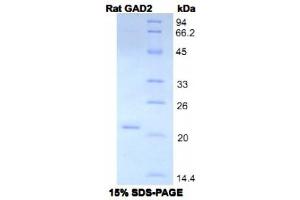 SDS-PAGE analysis of Rat GAD2 Protein. (GAD65 蛋白)