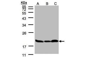 Western Blotting (WB) image for anti-Stathmin 1 (STMN1) (C-Term) antibody (ABIN2855912)