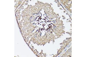 Immunohistochemistry (IHC) image for anti-Chemokine (C-X3-C Motif) Ligand 1 (CX3CL1) (AA 365-397) antibody (ABIN6139265)