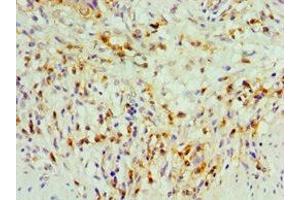 Immunohistochemistry of paraffin-embedded human gallbladder tissue using ABIN7171776 at dilution of 1:100 (TDGF1 抗体  (AA 35-188))