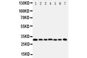 Western Blotting (WB) image for anti-Kallikrein 11 (KLK11) (AA 233-250), (C-Term) antibody (ABIN3043137) (Kallikrein 11 抗体  (C-Term))