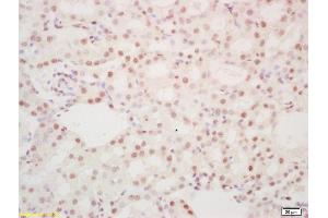 Formalin-fixed and paraffin embedded mouse kidney labeled with Rabbit Anti hospho-DDX5 (Tyr593) Polyclonal Antibody, Unconjugated (ABIN1387375) at 1:200 followed by conjugation to the secondary antibody and DAB staining (DDX5 抗体  (pTyr593))