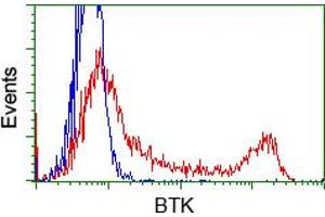 Image no. 1 for anti-Bruton Agammaglobulinemia tyrosine Kinase (BTK) antibody (ABIN1496975) (BTK 抗体)