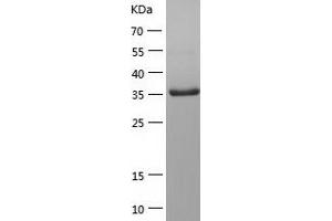Western Blotting (WB) image for RNA Polymerase II Subunit RPB1 (POLR2A) (AA 1586-1951) protein (His tag) (ABIN7124928)