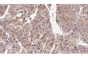 Immunohistochemistry (IHC) image for anti-Solute Carrier Family 2 (Facilitated Glucose Transporter), Member 1 (SLC2A1) (C-Term) antibody (ABIN6261995)