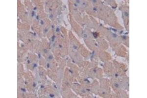 Used in DAB staining on fromalin fixed paraffin- embedded Kidney tissue (MYLK2 抗体  (AA 327-536))
