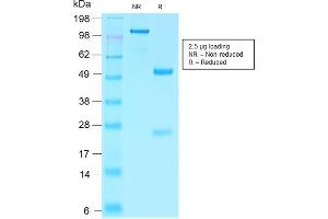 SDS-PAGE Analysis Purified Villin Rabbit Recombinant Monoclonal Antibody (VIL1/2310R). (Recombinant Villin 1 抗体  (AA 179-311))