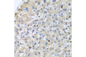 Immunohistochemistry of paraffin-embedded human liver using APOA5 antibody at dilution of 1:100 (40x lens). (APOA5 抗体)