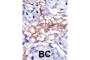 Immunohistochemistry (Paraffin-embedded Sections) (IHC (p)) image for anti-Phosphatidylinositol-5-Phosphate 4-Kinase, Type II, alpha (PIP4K2A) (AA 107-139), (N-Term) antibody (ABIN392597)