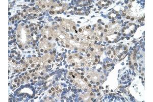 SNRP70 antibody was used for immunohistochemistry at a concentration of 4-8 ug/ml to stain Epithelial cells of renal tubule (arrows) in Human Kidney. (SNRNP70 抗体)