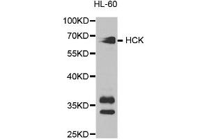 Western blot analysis of extracts of HL-60 cell lines, using HCK antibody. (HCK 抗体)