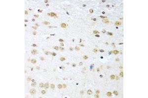 Immunohistochemistry of paraffin-embedded mouse brain using CCND2 antibody at dilution of 1:100 (40x lens). (Cyclin D2 抗体)