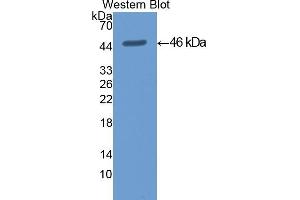Detection of Recombinant KRT19, Mouse using Polyclonal Antibody to Cytokeratin 19 (CK19) (Cytokeratin 19 抗体  (AA 1-403))