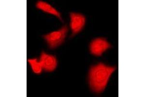 Immunofluorescent analysis of PKA C alpha/beta staining in Raw264. (PKA/C alpha/beta (N-Term) 抗体)