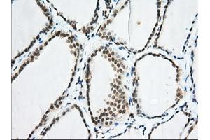 Immunohistochemical staining of paraffin-embedded Human colon tissue using anti-EIF2S1 mouse monoclonal antibody. (EIF2S1 抗体)