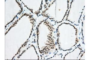 Immunohistochemical staining of paraffin-embedded Human colon tissue using anti-EIF2S1 mouse monoclonal antibody. (EIF2S1 抗体)