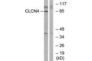 Western blot analysis of extracts from MCF-7 cells, using CLCN4 Antibody. (CLCN4 抗体  (AA 221-270))