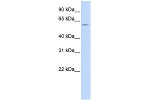 SLC15A4 antibody used at 1 ug/ml to detect target protein. (SLC15A4 抗体  (Middle Region))