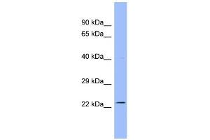 WB Suggested Anti-AK3L1 Antibody Titration:  0. (AK4 抗体  (N-Term))