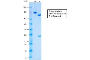 SDS-PAGE Analysis Purified CK LMW Rabbit Recombinant Monoclonal Antibody (KRTL/1577R). (Recombinant Keratin 77 抗体)