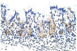 TROVE2 antibody was used for immunohistochemistry at a concentration of 4-8 ug/ml to stain Epithelial cells of fundic gland (arrows) in Human Stomach. (TROVE2 抗体  (N-Term))