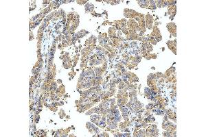 IHC analysis of ABI1 using anti-ABI1 antibody (ABIN3043515).