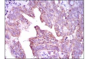 Western Blotting (WB) image for anti-Calcium/calmodulin-Dependent Protein Kinase IV (CAMK4) (AA 35-292) antibody (ABIN1845379)