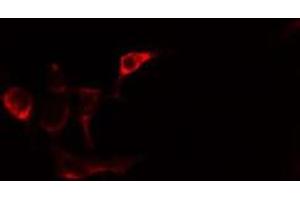 ABIN6275486 staining Hela cells by IF/ICC. (ALDH1A2 抗体  (C-Term))