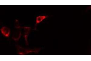ABIN6275486 staining Hela cells by IF/ICC.