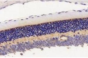 Immunohistochemistry analysis of paraffin-embedded mouse eyeball using,KCNV2 (ABIN7075150) at dilution of 1: 2800 (KCNV2 抗体)