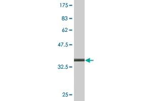 Western Blotting (WB) image for anti-Actin-Related Protein T2 (ACTRT2) (AA 209-299) antibody (ABIN530801)