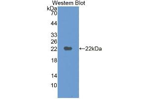 Western blot analysis of the recombinant protein. (M6PR 抗体  (AA 27-185))