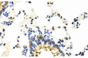 Immunohistochemistry of paraffin-embedded Rat lung using CRTAP Polyclonal Antibody at dilution of 1:100 (40x lens). (CRTAP 抗体)