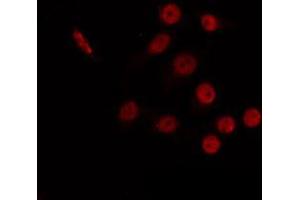 ABIN6266765 staining 293 by IF/ICC. (CBX6 抗体  (N-Term))