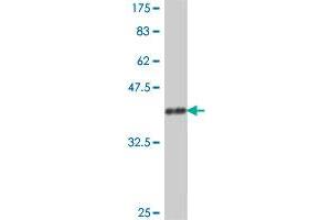 Western Blot detection against Immunogen (37 KDa) . (PARN 抗体  (AA 501-599))
