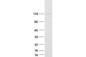 Western Blotting (WB) image for Homeobox protein SIX5 (SIX5) protein (Myc-DYKDDDDK Tag) (ABIN2732100)