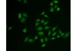 Immunofluorescence analysis of U2OS cells using SSRP1 antibody (ABIN6129537, ABIN6148493, ABIN6148495 and ABIN6222048). (SSRP1 抗体  (AA 1-300))