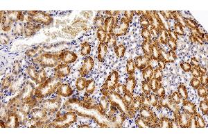 Detection of CAT in Mouse Kidney Tissue using Polyclonal Antibody to Catalase (CAT) (Catalase 抗体  (AA 401-523))