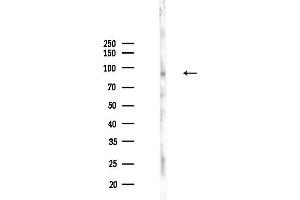 Western blot analysis of lysates from PC12 cells(UV,30 min treatment), using Phospho-S (Tyr641) Antibody at 1/1000 dilution.