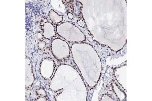 Immunohistochemical staining of human thyroid gland with POFUT2 polyclonal antibody ( Cat # PAB28284 ) shows moderate nuclear positivity in glandular cells at 1:20 - 1:50 dilution. (POFUT2 抗体)