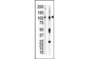 Western blot analysis of anti-PKCnu Pab in lysate of HL60 cells stimulated with PMA (lane A) and mouse brain tissue lysate (lane B). (PRKD3 抗体  (Middle Region))