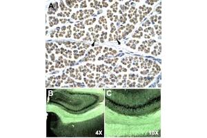 Immunohistochemical staining (Formalin-fixed paraffin-embedded sections) of human muscle (A) and rat brain (B, C) with GABRD polyclonal antibody . (GABRD 抗体  (N-Term))
