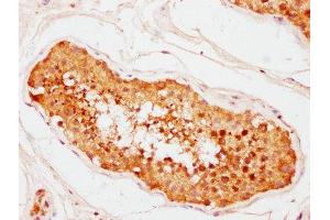 IHC image of ABIN7147093 diluted at 1:400 and staining in paraffin-embedded human testis tissue performed on a Leica BondTM system. (CNOT1 抗体  (AA 595-744))