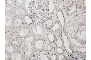 Immunostaining (ISt) image for anti-X-Ray Repair Complementing Defective Repair in Chinese Hamster Cells 1 (XRCC1) (AA 1-633) antibody (ABIN521422)