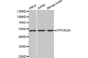 Western blot analysis of extracts of various cell lines, using PPP2R2A antibody. (PPP2R2A 抗体)