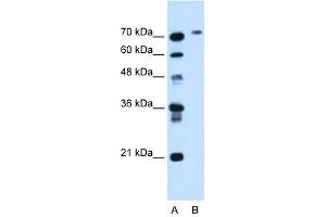BCHE antibody used at 1. (Butyrylcholinesterase 抗体  (N-Term))