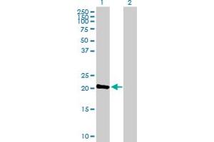 Western Blot analysis of C1orf57 expression in transfected 293T cell line by C1orf57 MaxPab polyclonal antibody. (C1orf57 抗体  (AA 1-190))