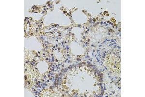 Immunohistochemistry of paraffin-embedded rat lung using PLK4 antibody (ABIN6003595) at dilution of 1/100 (40x lens). (PLK4 抗体)