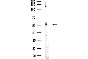 Western blot analysis of lysates from COLO205 cells(heat-shock,45 min treatment), using PSMC1 Antibody at 1/1000 dilution.